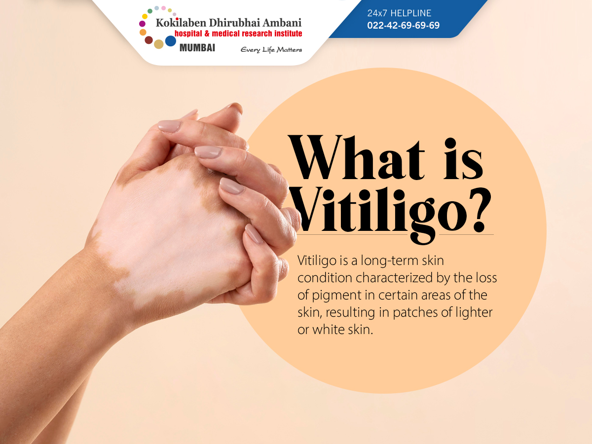 KDAHMumbai's tweet photo. Treatment options for #vitiligo are available to help manage the symptoms. If you suspect you have vitiligo or notice any #skinchanges, consult a #dermatologist for an accurate diagnosis and appropriate treatment options. #WorldVitiligoDay https://t.co/IewiDHbyj9