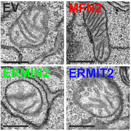 Ermin2 and Ermit2 do not influence mitochondrial morphology. Ermin2 regulates ER shape and luminal connectivity. Ermit2 is enriched in MAMs. Ermit2 increases ER-mito proximity measured by ddGFP, FEMP, EM. In cells, Ermit2 supports Ca2+ transfer from ER to mitochondria 3/