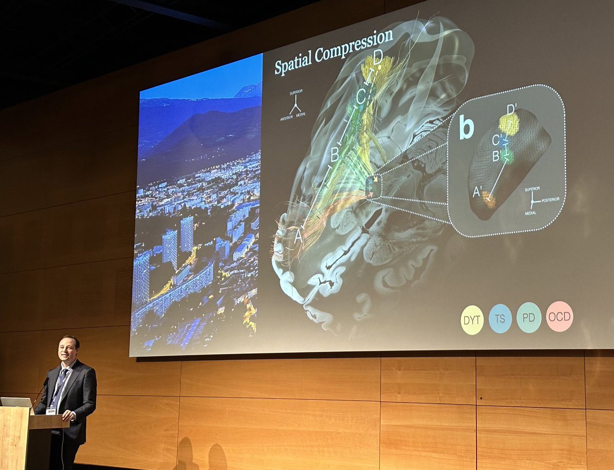 Mark Richardson MD PhD (@rmarkrichardson) on Twitter photo Itās been a little while since Iāve seen <a href="/andreashorn_/">Andreas Horn</a> present in person at a meeting like this first meeting of the <a href="/dbssocietyorg/">Deep Brain Stimulation Society</a> - I always learn (and re-learn) not only important #DBSscience, but also strategies for presenting science, from his clear visualizations. Itās been a little while since Iāve seen <a href="/andreashorn_/">Andreas Horn</a> present in person at a meeting like this first meeting of the <a href="/dbssocietyorg/">Deep Brain Stimulation Society</a> - I always learn (and re-learn) not only important #DBSscience, but also strategies for presenting science, from his clear visualizations.