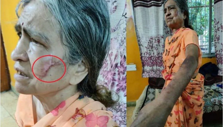 ShefVaidya's tweet photo. Scumred Inayat Pardeshi who tortured and beat his old mother to death was a writer with @thewire_in where he used to write articles about ‘patriarchy and women’s rights’. His mother, Sarojini Kamble was a Marxist thinker who wrote about ‘अब्राह्मणी स्त्रीमुक्ती’, but could NOT raise her own son to respect women! 

Inayat tortured his mother by beating her, scalding her on the face with a red hot pair of tongs and even forced her to drink his own bed-ridden father’s urine for years. Many of their fellow commies were aware of this fact, but did nothing to help the old Pardeshi couple. 

Strangely @svaradarajan @nandinisundar and other vocal feminists and commies are completely silent on this crime, because the kiIIer is one of their own!