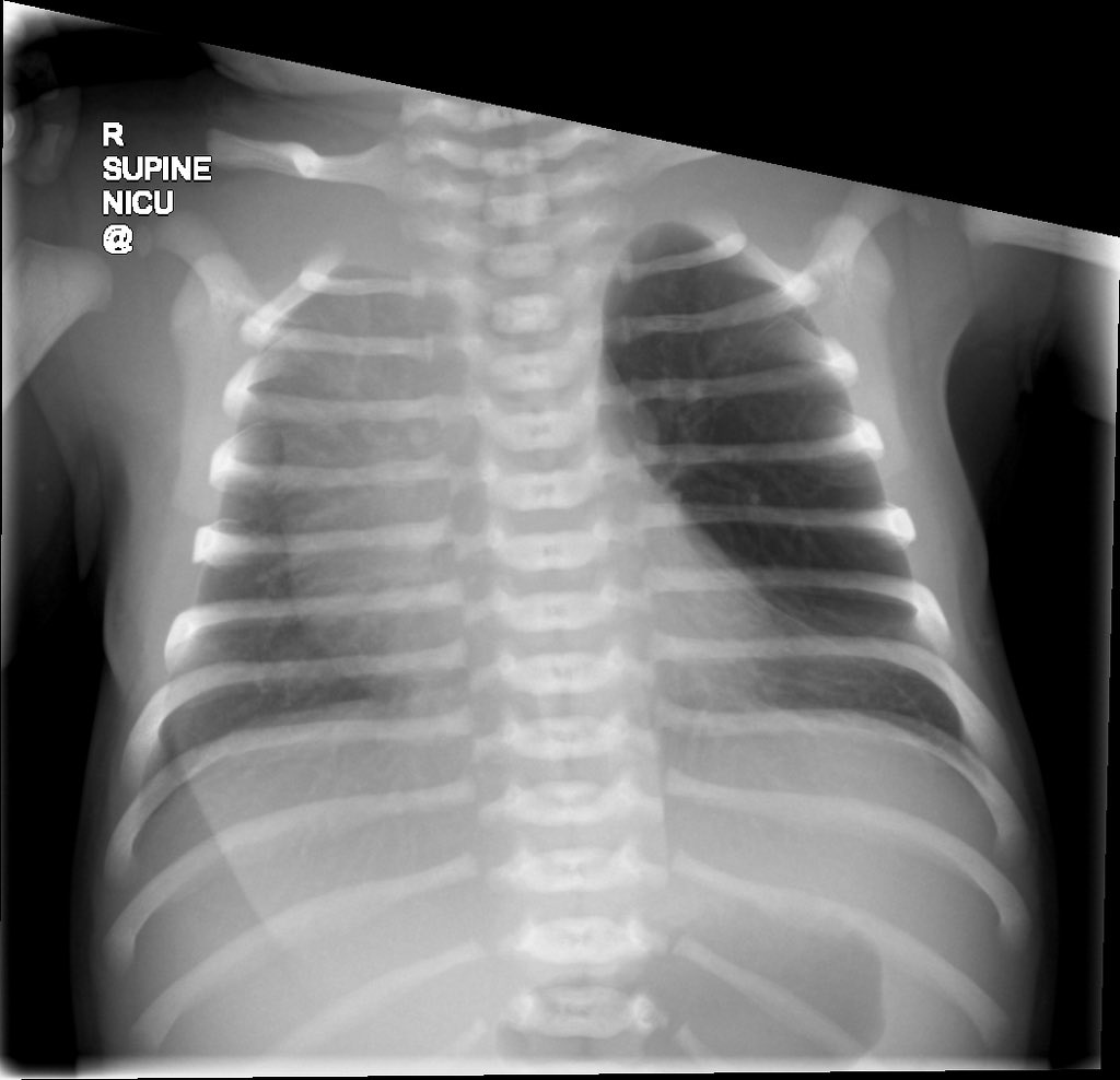 Andrew Dixon tweet media