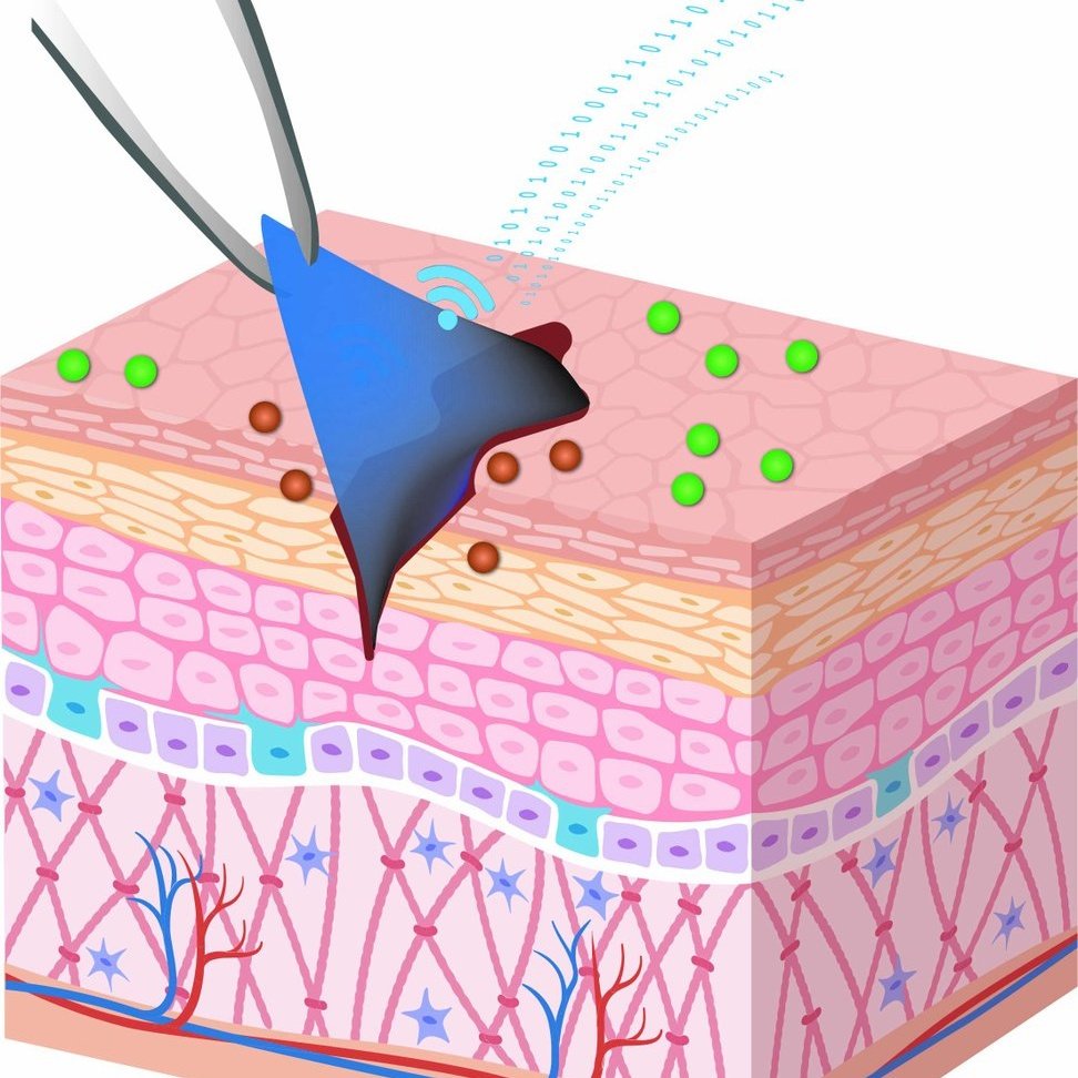 Antimikrobiyal biyoyapışkanlar ile ilgili gerçekleştirdiğimiz ve Advanced Materials dergisinde (Impact factor: 32.1) yayınlanan çalışmamız LinkedIn platformunda sadece ilk 24 saatte 10 binden fazla etkileşime ulaştı.
doi.org/10.1002/adma.2…

<a href="/baruedutr/">Bartın Üniversitesi</a> <a href="/METU_ODTU/">METU / ODTÜ</a> <a href="/uzun_orhan/">ORHAN UZUN</a>