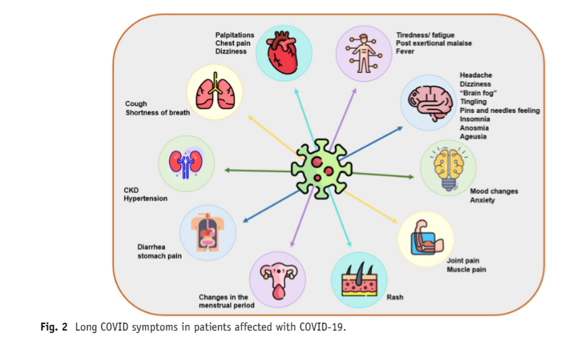 Sudha Mannemuddhu, MD, FAAP, FASN, FNKF (@drm_sudha) on Twitter photo Check out this review on "Practical Approaches to Management of Children With #COVID19 and Kidney Disease: the Known, Unknown, and the Future"
by <a href="/RoshanPGeorgeMD/">Roshan George</a> <a href="/Ashley_Rawson/">Ashley Rawson</a> & me
rdcu.be/dfbbO
<a href="/SpringerNature/">Springer Nature</a> Check out this review on "Practical Approaches to Management of Children With #COVID19 and Kidney Disease: the Known, Unknown, and the Future"
by <a href="/RoshanPGeorgeMD/">Roshan George</a> <a href="/Ashley_Rawson/">Ashley Rawson</a> & me
rdcu.be/dfbbO
<a href="/SpringerNature/">Springer Nature</a>