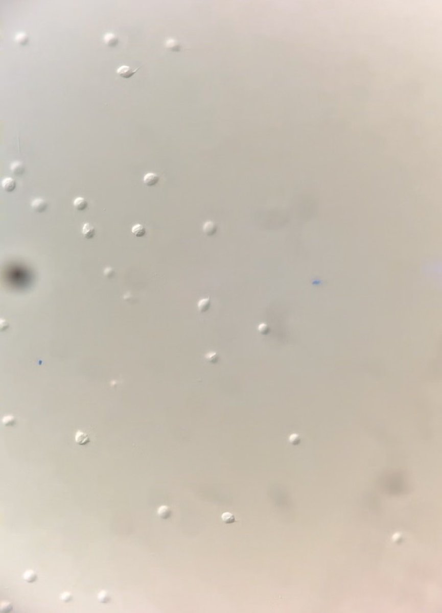 MaidenStephanie's tweet photo. Never thought I would need to image worm sperm but here we are… 

C. elegans male spermatids dissected by my summer student Trace and imaged using a 63x oil objective on a DIC scope. https://t.co/KiDMoazhPY