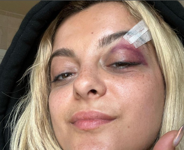 THEFUNCRUISE1's tweet photo. Singer Ava Max slapped by fan on stage days after Bebe Rexha's attack

#AvaMax #TheFunCruise https://t.co/OpIoAUMclw