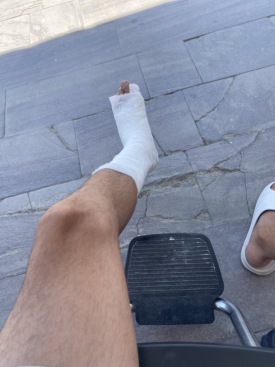 krokise's tweet photo. 3 aydır dükkanı açmak için uğraşıyoruz, açılış günü ayağımı kırdım. yakışır amk https://t.co/ciNys6SdRC