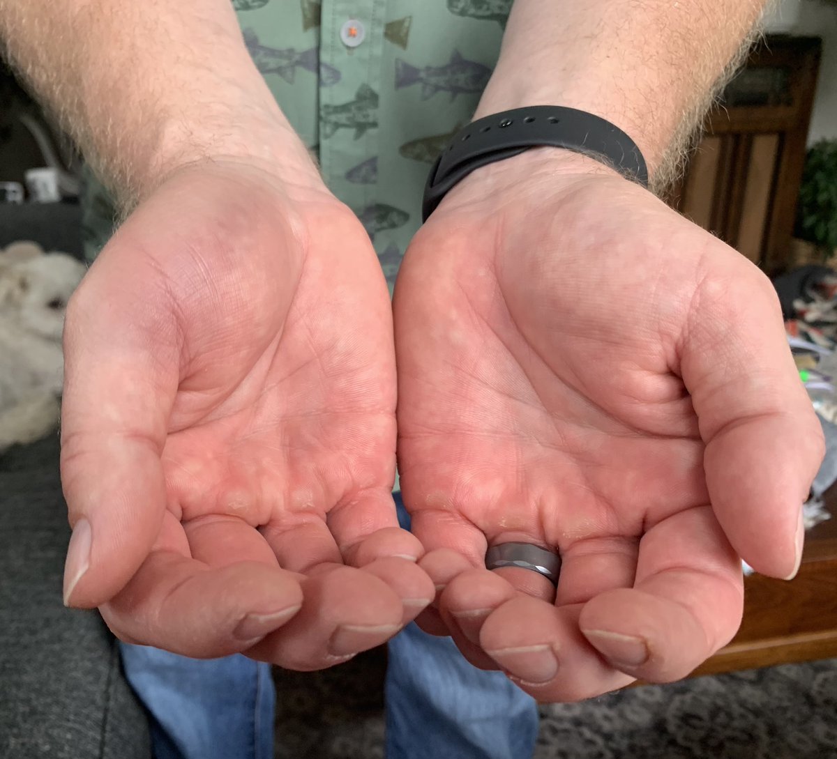 thebeertruck's tweet image. Played tetherball yesterday for the first time in 35 years. The bottom of my right thumb paid the price. Well worth it! My ten year old nephew had been talking smack for days trying to get me to play him. I did. The smack talk has stopped. #detroyedhim #tetherball
