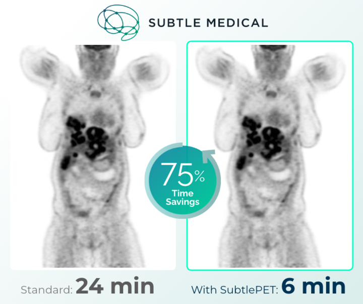 SubtleMedical's tweet photo. The Subtle Medical team is heading to Chicago to showcase our AI-powered #SubtlePET software for faster PET Imaging at the 2023 Society of Nuclear Medicine and Molecular Imaging (@SNM_MI) conference this weekend.
Schedule time onsite to meet with the team and learn more about how SubtlePET can help enable up to 75% faster PET imaging to enhance patient comfort and increase throughput.
Read more here: https://t.co/rybravG2IO