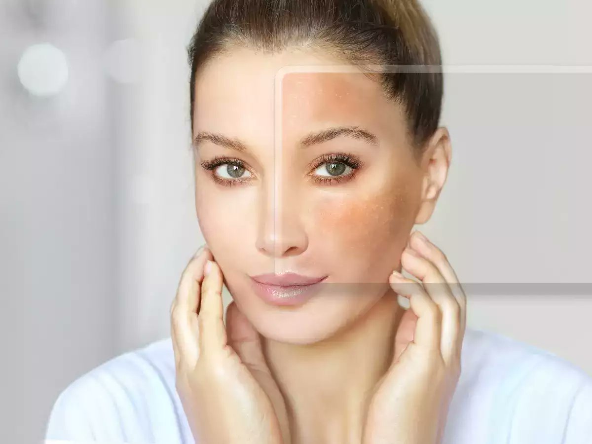 shibanijoshi's tweet image. New application of Dr. Google. Worried about a rash or mole? Check with Google Lens, your new first step skin consultant bit.ly/42VPZYk #google #heathtech