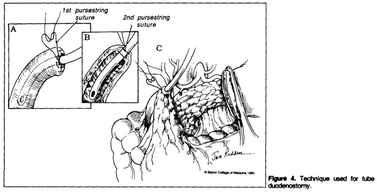 The Innovation Medicine on Twitter "RT Cirbosque Management of the