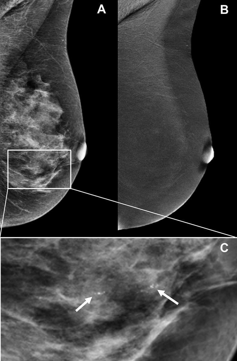 Radiology on Twitter "A deep learning algorithm accurately identified