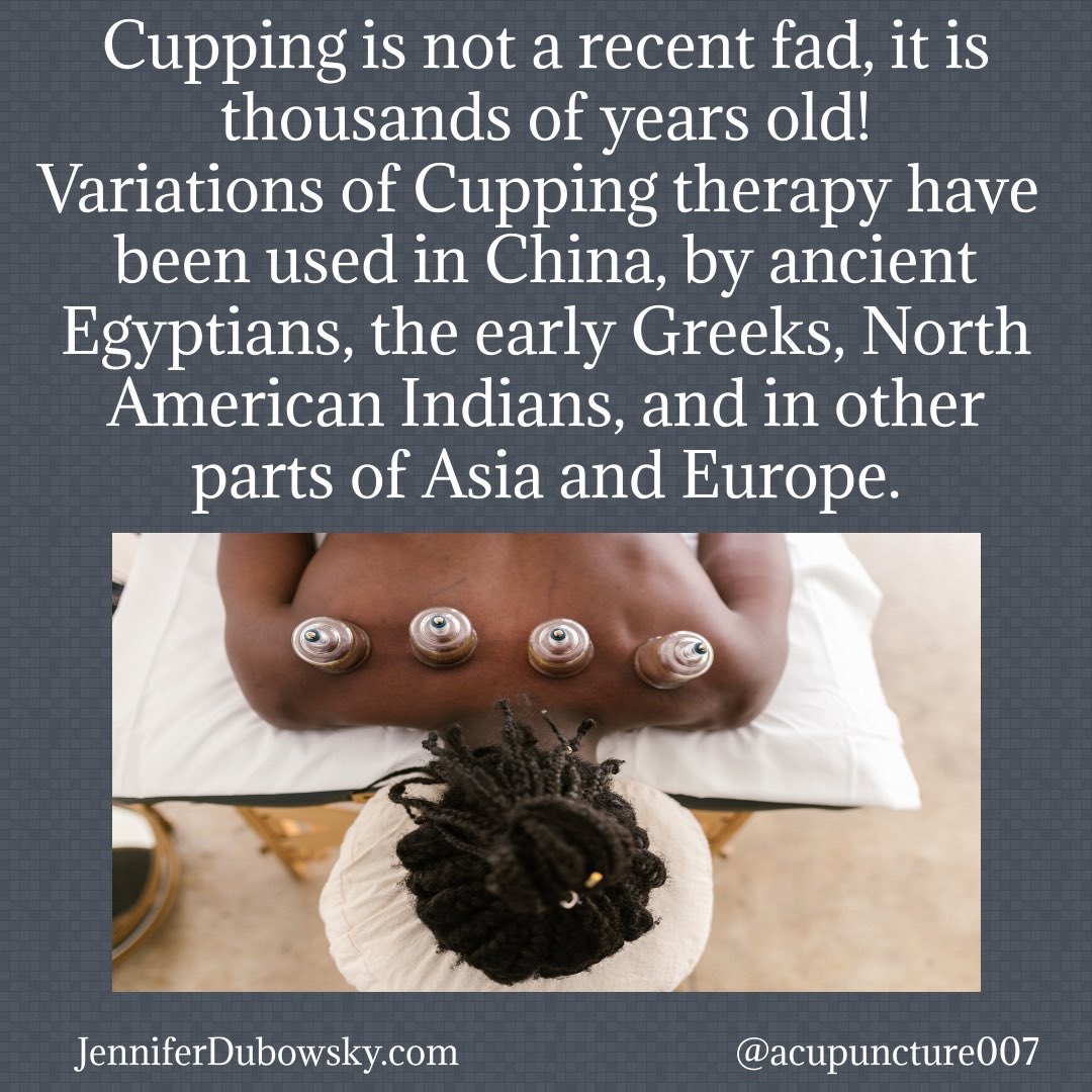 #Cupping is 1000’s of years old. #chinesemedicine