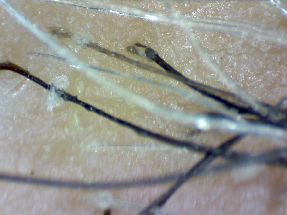 SisterlocksBlog's tweet image. Sisterlocks Birthday Month - Day 23 - mailchi.mp/sisterlocks.co…
In 2016 we created a Trichology Analyst program. One of my post-pandemic goals for Sisterlocks is to reinvigorate that program. There are so many of us out there who could use a little help with our hair loss issues.