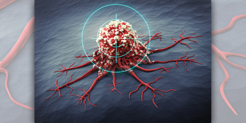 Cancer Discovery (@cd_aacr) on Twitter photo Read this week's Cancer Discovery #ResearchWatch:
Conformal Radiotherapy Efficacy Depends on Monocyte IFN-I Signaling, summarizing the work of <a href="/siritadepalli/">Sirimuvva Tadepalli</a>, <a href="/dr536773/">Derek Clements</a>, <a href="/Idoyaga_Lab/">Idoyaga Lab</a> et al.
bit.ly/44i51IC
<a href="/StanfordMed/">Stanford Medicine</a> Read this week's Cancer Discovery #ResearchWatch:
Conformal Radiotherapy Efficacy Depends on Monocyte IFN-I Signaling, summarizing the work of <a href="/siritadepalli/">Sirimuvva Tadepalli</a>, <a href="/dr536773/">Derek Clements</a>, <a href="/Idoyaga_Lab/">Idoyaga Lab</a> et al.
bit.ly/44i51IC
<a href="/StanfordMed/">Stanford Medicine</a>