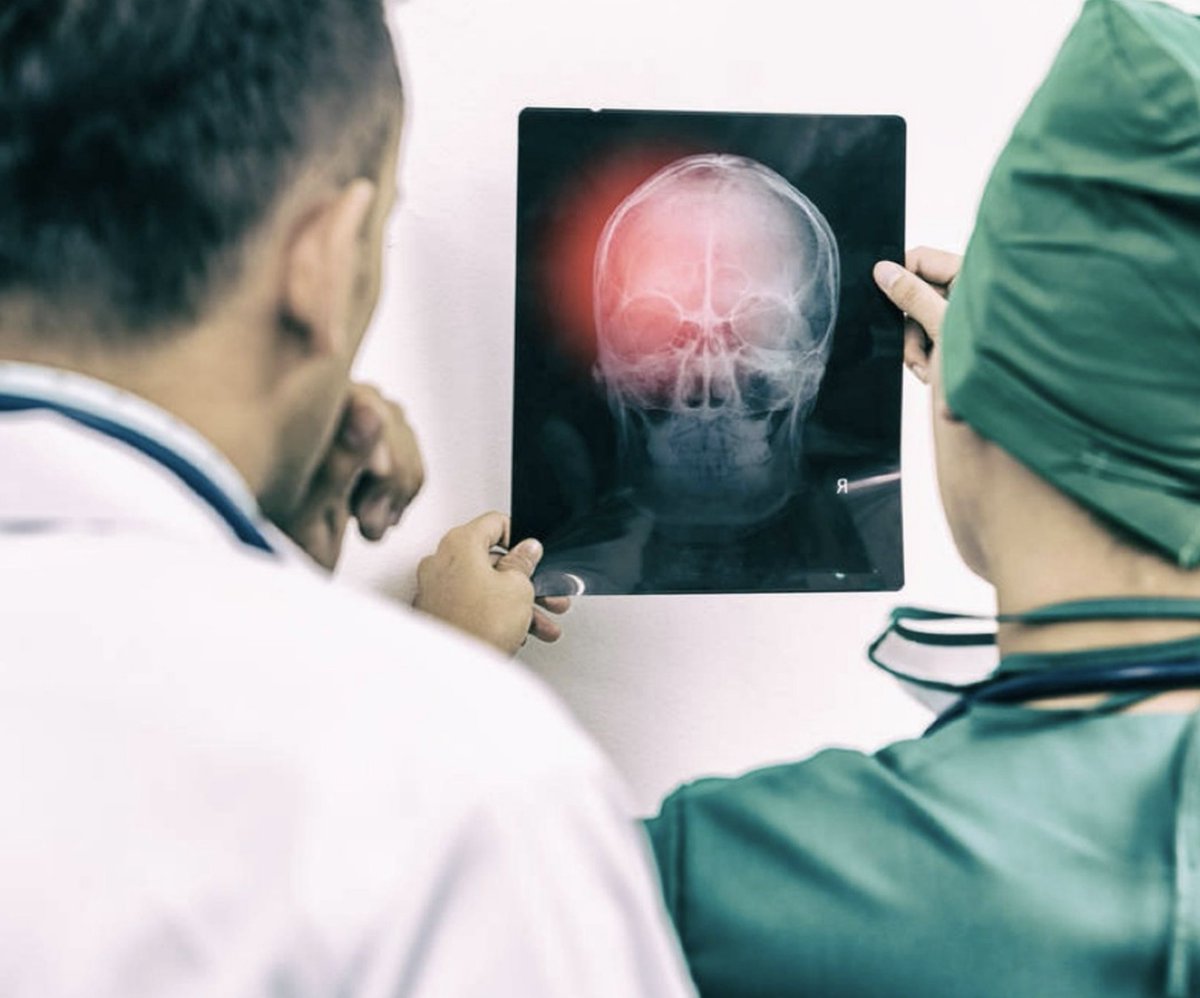 Depending on how serious your head injury is, a skilled Lynchburg personal injury lawyer at Trost Law Group can help.

#braininjury #tbi #braininjuryawareness #stroke #concussion #traumaticbraininjury #braininjurysurvivor #brainhealth #headinjury #brain #rehabilitation