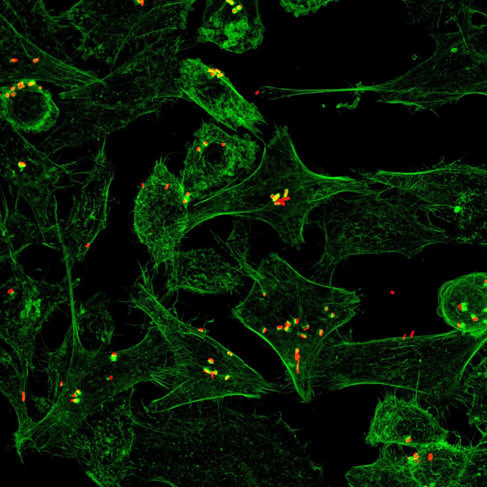 Janelle Ayres and @grischachen find pairing specific diets with diarrheal disease-causing bacteria creates lasting immunity in mice—w/out symptoms of the illness. Their discovery may lead to a vaccine for diarrheal infections in humans @ScienceAdvances bit.ly/3p3UQZy