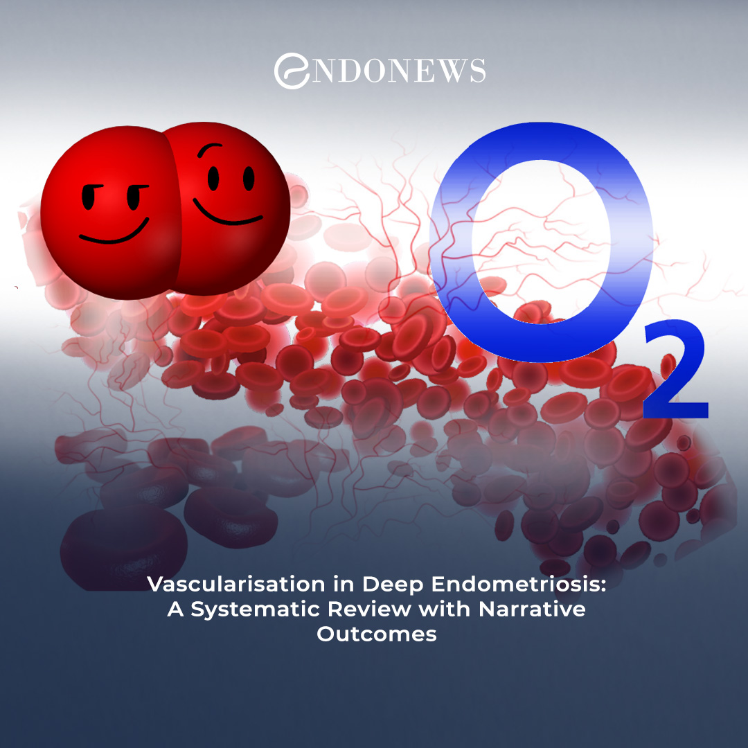 Targeting Angiogenesis in Deep Endometriosis

Read More:
endonews.com/unraveling-the…

#VEGF  #microvesseldensity #endometriosis