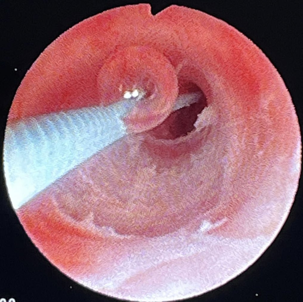 Augusto Alcacio, MD tweet media