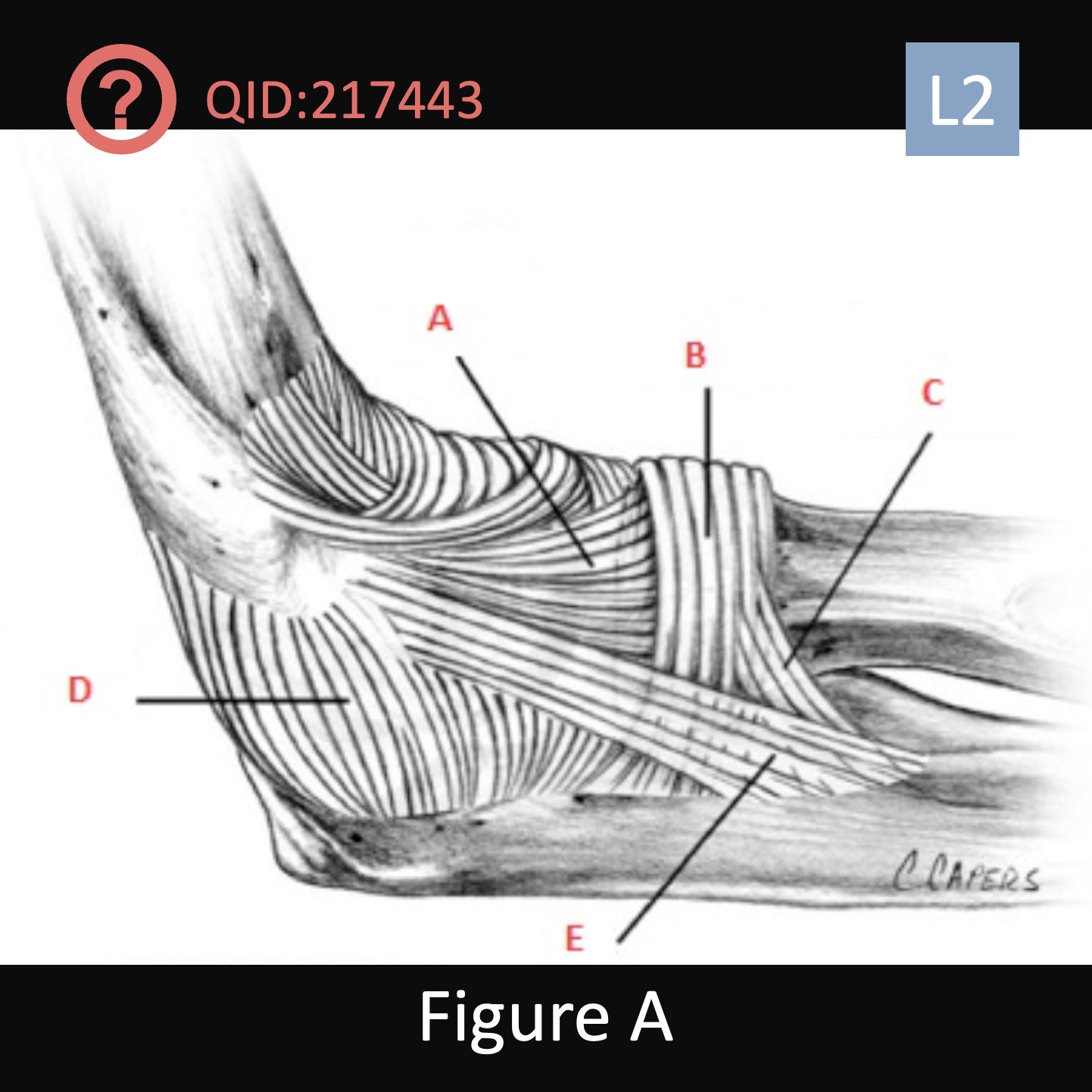 Orthobullets On Twitter Can You Answer This Daily Question From Our orthobullets-on-twitter-can-you-answer-this-daily-question-from-our