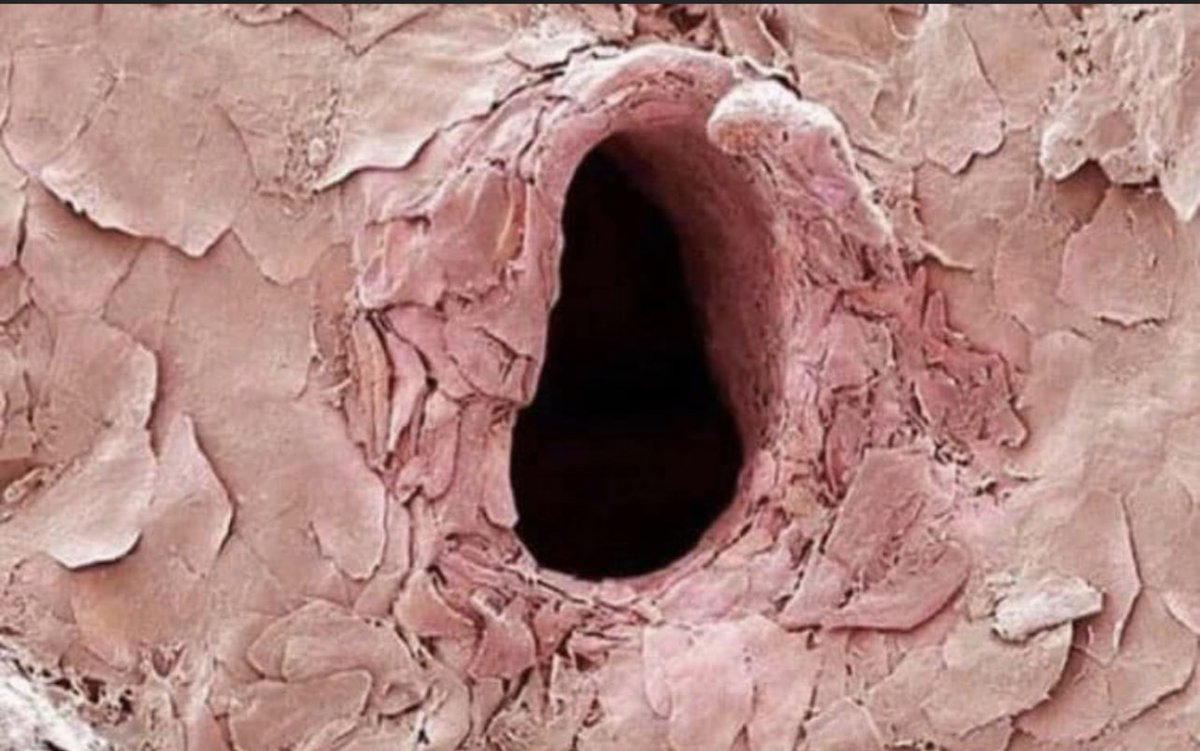 DrBenTapper1's tweet image. This is a close up of the skin after a needle penetrates it.
The whole vaccine philosophy can be flopped on its head by understanding what immune responses are released during/after a vaccination. We are told it takes two weeks for the body to build up the right antibodies to the…