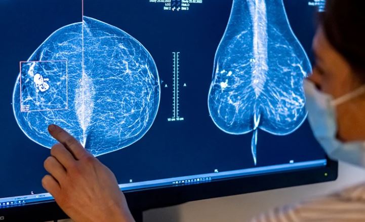 editor_lilly's tweet photo. Huge leap in breast-cancer survival rate
Women diagnosed since 2010 have a much lower risk of dying than those diagnosed in the 1990s

For more information visit: https://t.co/AjFL2osRHW

#breastcancer #Cancer #conference #Paris #France #BTSLoveMyself #breastcancerawareness https://t.co/O05VQMIdRR