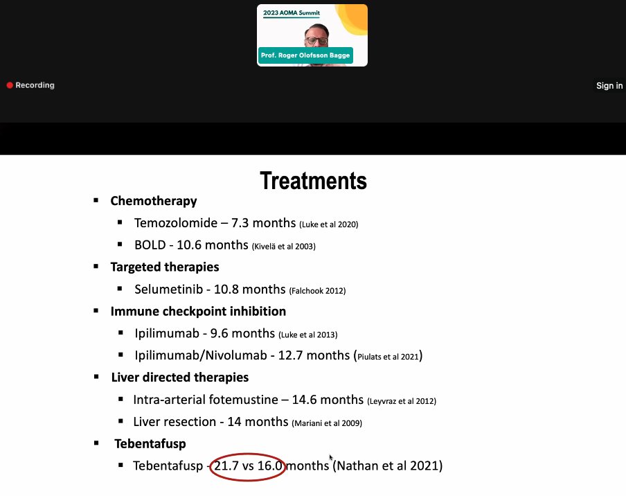 AOMA_MASC's tweet photo. @OlofssonBagge talking at the AOMA Summit about the incidence of uveal melanoma in 🇸🇪. #Tebentafusp has increased survival rates. He also talks about isolated hepatic perfusions, a patient registry study in Sweden, and the SCANDIUM trial. https://t.co/4W6PEEnmme
