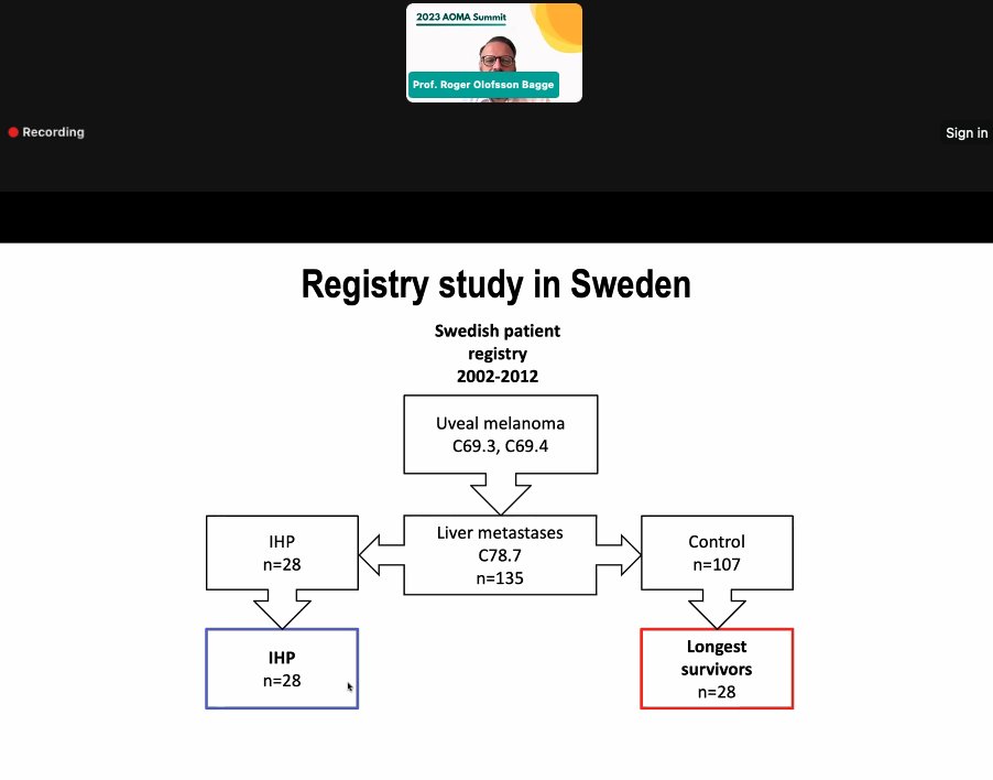 AOMA_MASC's tweet photo. @OlofssonBagge talking at the AOMA Summit about the incidence of uveal melanoma in 🇸🇪. #Tebentafusp has increased survival rates. He also talks about isolated hepatic perfusions, a patient registry study in Sweden, and the SCANDIUM trial. https://t.co/4W6PEEnmme