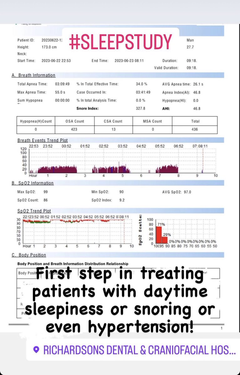 #sleepstudy #daytimesnoring #hypertension