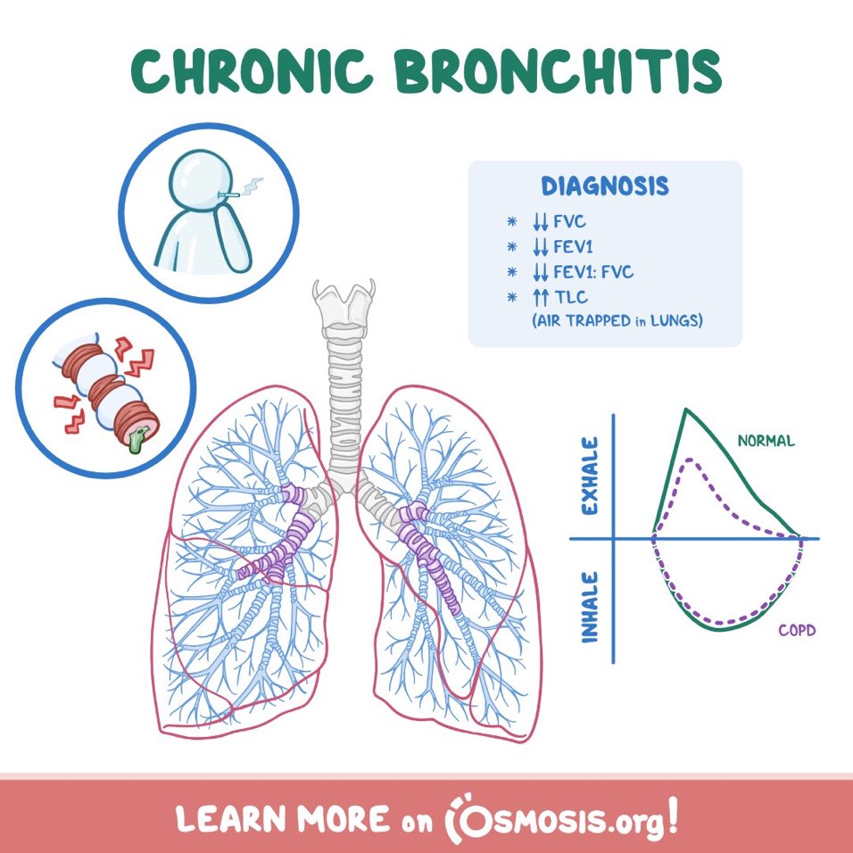 CHRONIC BRONCHITIS