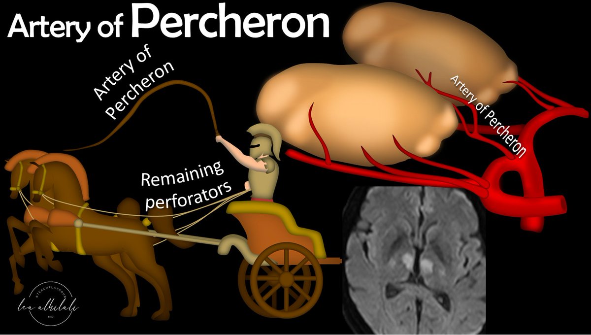 @Drgomathi_tn Artery of percheron

Pic credits- @teachplaygrub

twitter.com/teachplaygrub/…
