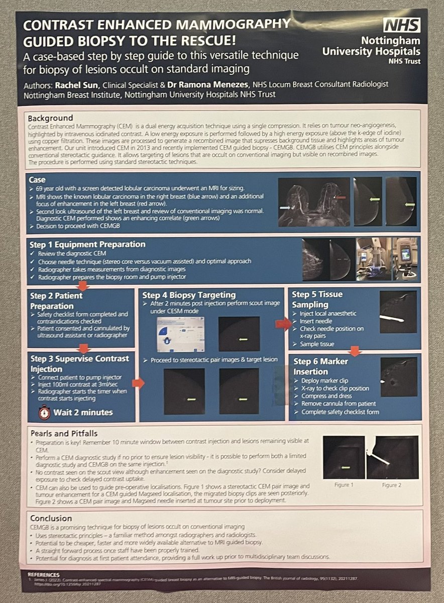 Jonathan James (@drjonjames) on Twitter photo Prizes for the @TeamNUH breast imagers <a href="/SympMamm/">Symp Mamm</a>.  The prestigious Caroline Roney Award to <a href="/egilbert178/">Emily Gilbert</a> for her work on "Breast Screening for Transgender People" and 1st prize to Rachel Sun for #CEM guided biopsy. Great work, congratulations👏👏
<a href="/nottmhospitals/">Nottingham University Hospitals</a> <a href="/nibec_education/">Nottingham Breast Ed 💙</a> Prizes for the @TeamNUH breast imagers <a href="/SympMamm/">Symp Mamm</a>.  The prestigious Caroline Roney Award to <a href="/egilbert178/">Emily Gilbert</a> for her work on "Breast Screening for Transgender People" and 1st prize to Rachel Sun for #CEM guided biopsy. Great work, congratulations👏👏
<a href="/nottmhospitals/">Nottingham University Hospitals</a> <a href="/nibec_education/">Nottingham Breast Ed 💙</a>