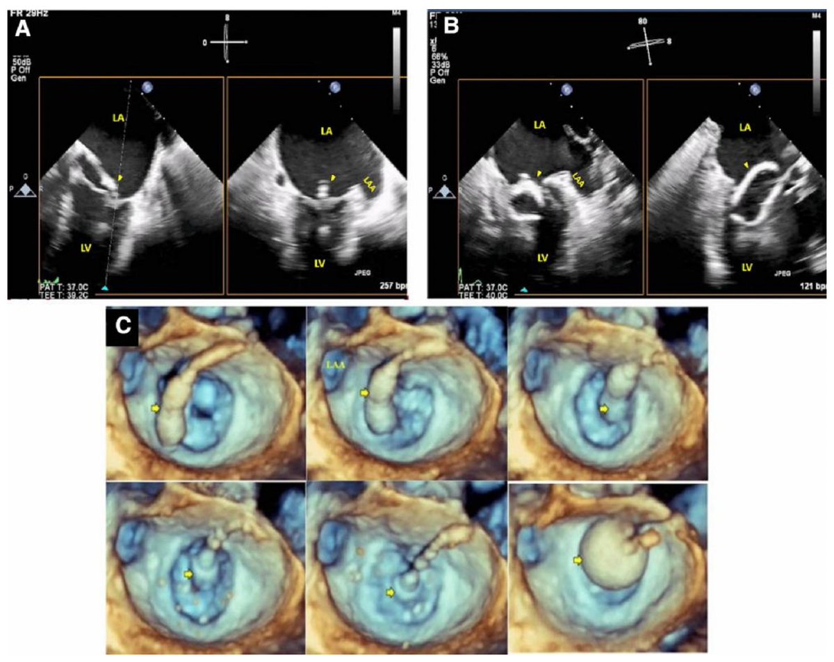 EHJCVI Editor-in-Chief tweet media