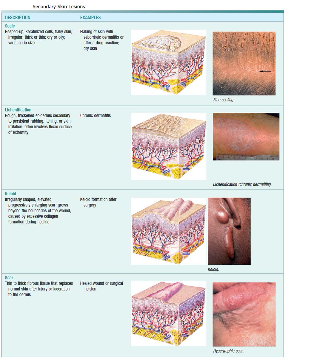 Manual Of Medicine on Twitter "Secondary Skin Lesions"