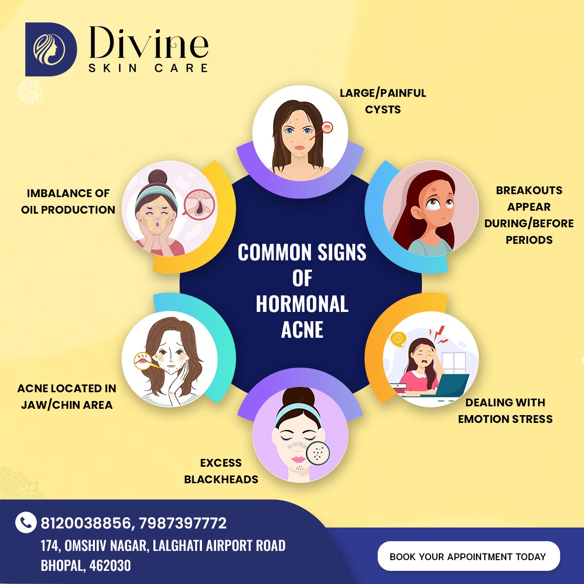 Hormonal acne refers to breakouts that occur due to hormone fluctuations, particularly a rise in androgens such as testosterone. ✨
#hormonalacne #hormonal #acne #acnehormones #healthyskin #skin #care #health #procedure #skintreatement #divineskinclinic #divine #divineskincare