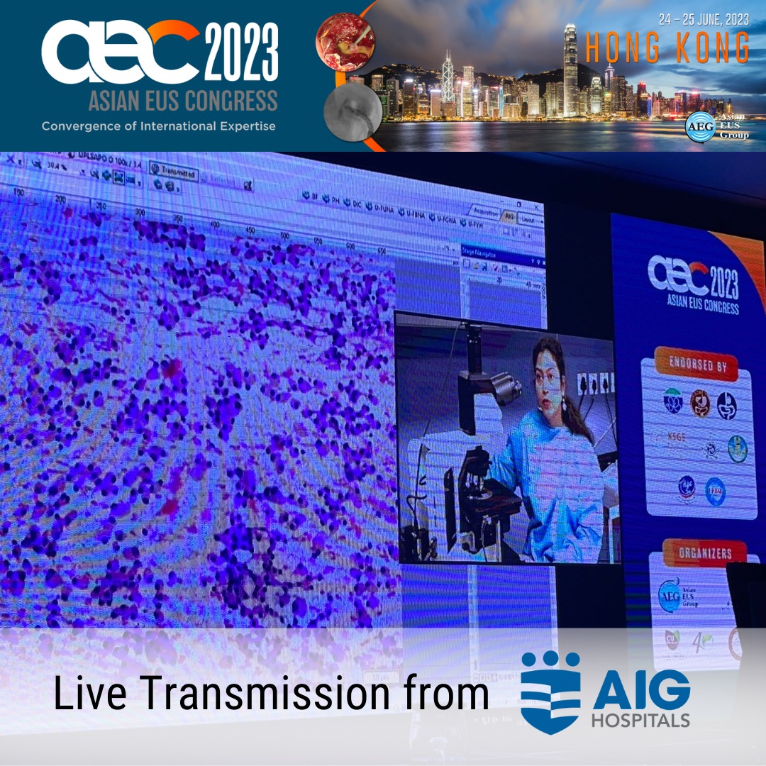 Today, we did the LIVE transmission of advanced #EUS (Endoscopic Ultrasound) procedures for the biggest EUS conference in Asia, the bi-annual Asian EUS Congress in Hong Kong organized by the Asian EUS Group under the leadership of Prof Anthony Teoh (teoh_anthony). #AEC2023…