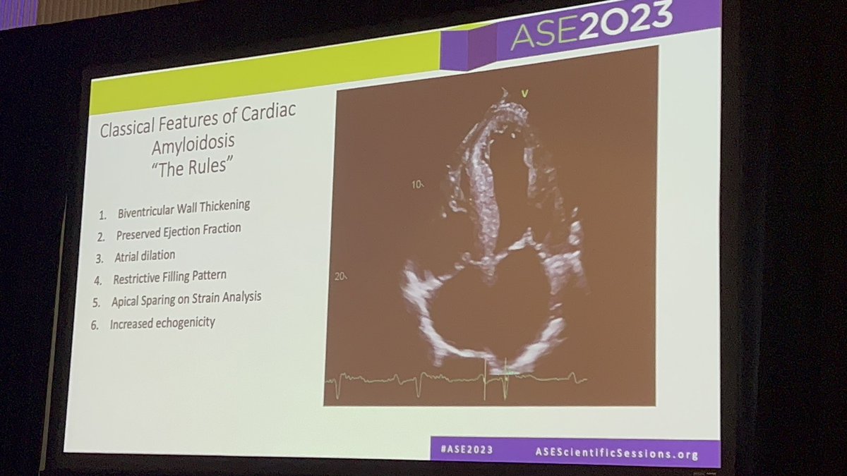 Siddharth Trivedi, BSc BMedS MBBS PHD FRACP FCSANZ (@siddhartht22) on Twitter photo Outstanding ASE2023 <a href="/ASE360/">American Society of Echocardiography</a> talk on echo findings in cardiac amyloidosis by Dr Sarah Cuddy <a href="/sarahcud/">Sarah Cuddy</a> <a href="/BrighamWomens/">Brigham and Women's Hospital</a> <a href="/BWHCVImaging/">Brigham and Women’s Cardiovascular Imaging Program</a> <a href="/BrighamFellows/">Brigham & Women's CV Fellows</a> <a href="/mdicarli/">Marcelo Di Carli</a> <a href="/DorbalaSharmila/">Sharmila Dorbala</a> <a href="/RonBlankstein/">Ron Blankstein</a> <a href="/RKwongMD/">Raymond Kwong</a> Outstanding ASE2023 <a href="/ASE360/">American Society of Echocardiography</a> talk on echo findings in cardiac amyloidosis by Dr Sarah Cuddy <a href="/sarahcud/">Sarah Cuddy</a> <a href="/BrighamWomens/">Brigham and Women's Hospital</a> <a href="/BWHCVImaging/">Brigham and Women’s Cardiovascular Imaging Program</a> <a href="/BrighamFellows/">Brigham & Women's CV Fellows</a> <a href="/mdicarli/">Marcelo Di Carli</a> <a href="/DorbalaSharmila/">Sharmila Dorbala</a> <a href="/RonBlankstein/">Ron Blankstein</a> <a href="/RKwongMD/">Raymond Kwong</a>