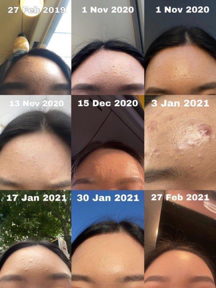 KUMPULAN MOISTURIZER UNTUK MAMPERBAIKI SKIN BARRIER ‼️
—
A thread