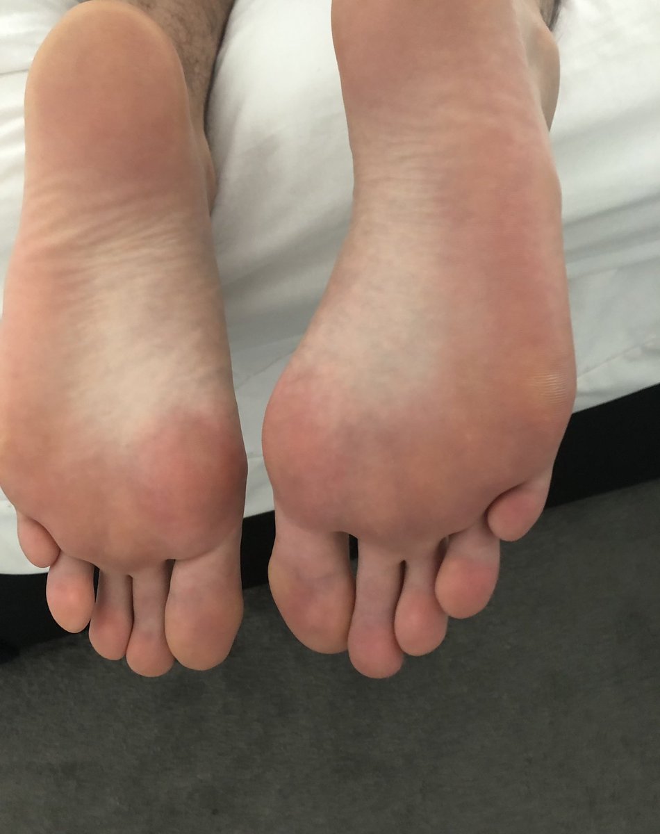_Maitre_J's tweet photo. I get why you’re obsessed.
Available tomorrow for a humiliation session.

#footmaster #footslave #alphamale #londonfindom #spitfetish #feetworship #cashmaster #malefeet #londonslave #londonhumiliation #londonfeet #dirtyfeet #dirtymalefeet #findom #cashmeet #cashmeet https://t.co/T7ZDyFv6TO