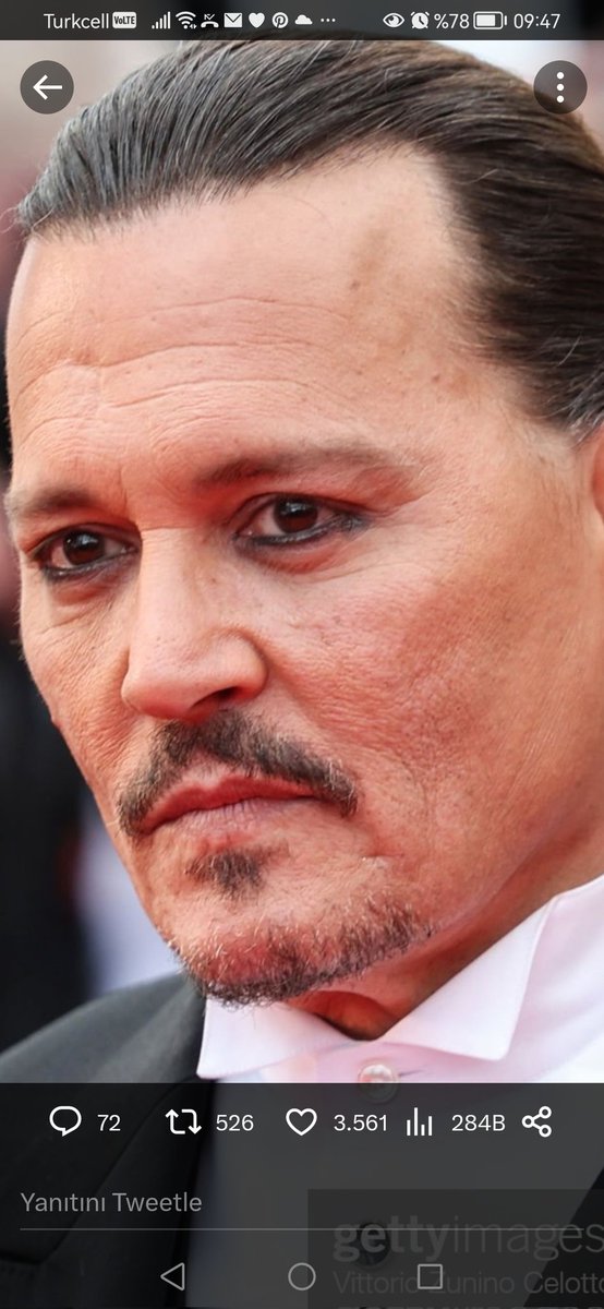 okoprenses5's tweet photo. You made me suffer so much, you persecuted me
You didn't know the value of my pure love, my love
You tried so hard for the whole world to humiliate me
But Johnny I'm still standing tall
And with my dignity and the people who surround me who love me
I won
Johnny
I won
#Toarmina https://t.co/cRjgpL7WYN