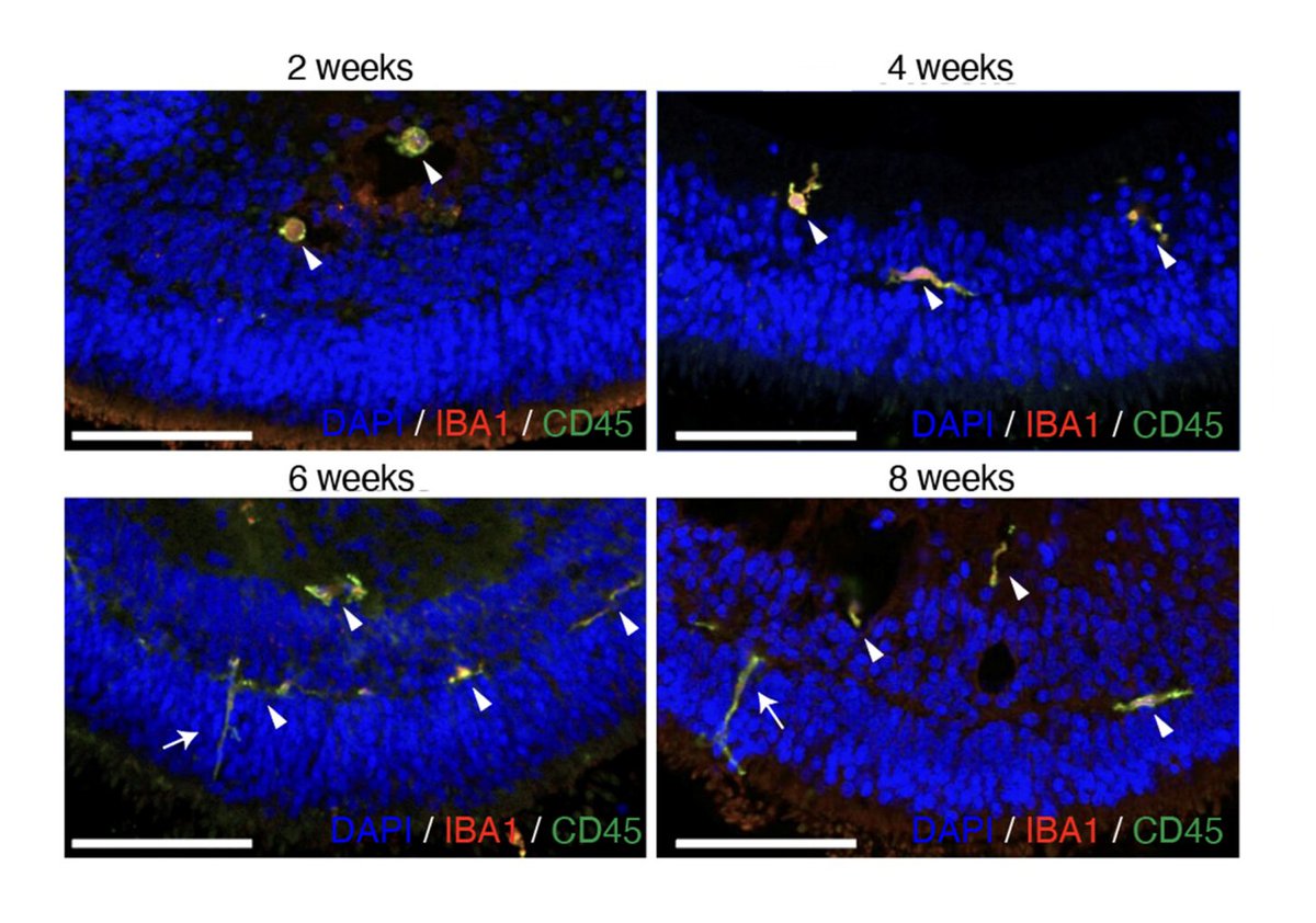 💡 Scientists developed a new 3D in vitro tissue model of microglia-containing retinal organoids by co-culturing retinal #organoids and hiPSC-derived macrophage precursor cells. @scrippsresearch

➡️ bit.ly/4315PAG