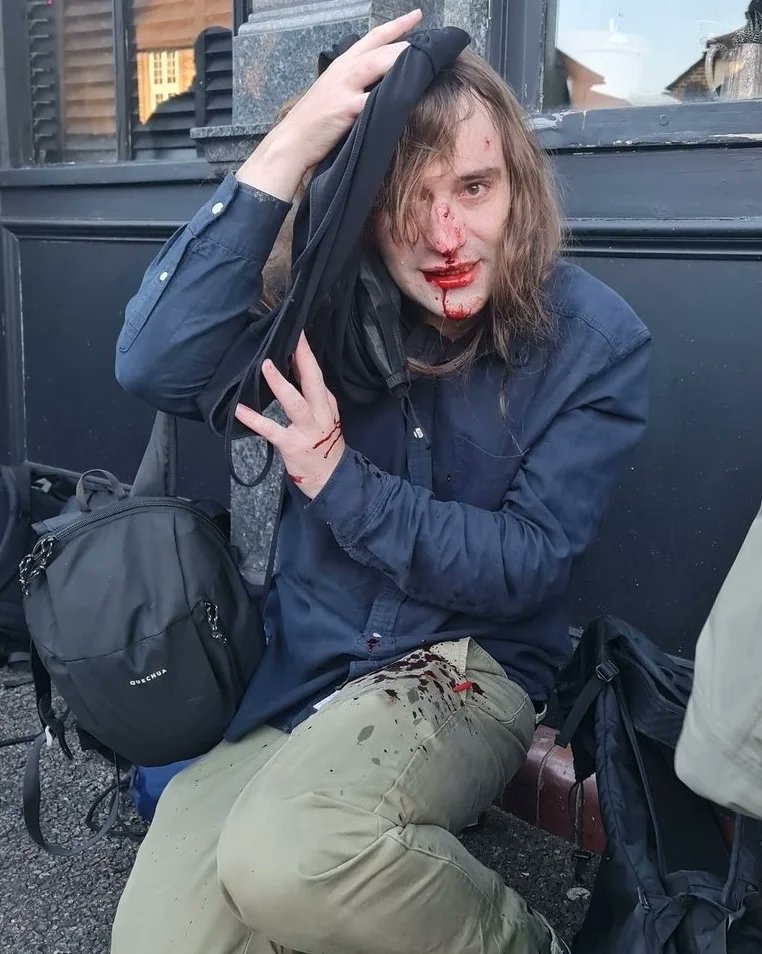 I was at Honor Woke this morning but got there late (hence my earlier Tweet).  I'm told Trantifa had knives, bottles, and sharpened sticks. They targeted the GC women then ran back into their crowd. 3 got arrested. Hence this...@TheTelegraph__
