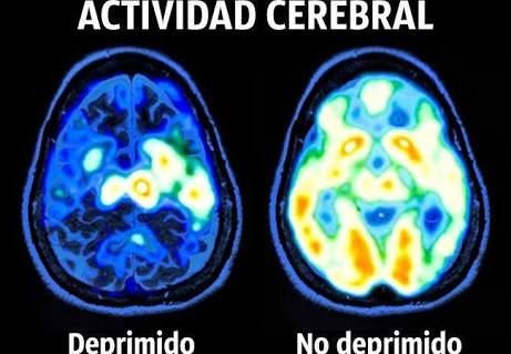 Acabo de ver esta película, que manera tan real de enfocar el tema de la #depresión y la #ansiedad. 
Esta película te transmite el sufrimiento de la persona deprimida y de quienes están a su alrededor, la familia. 
Ojalá pudieramos comprender que el tiempo deja de correr para una