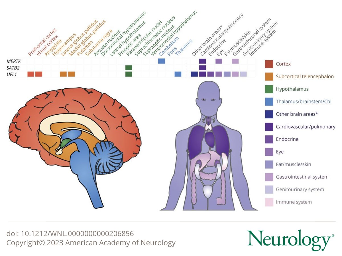 Circadian Features of Cluster Headache and #Migraine: A Systematic Review, Meta-analysis, and Genetic Analysis bit.ly/3oCK9wM

CME Opportunity: Read the article then click the "CME Course" tab to begin. #NeuroTwitter