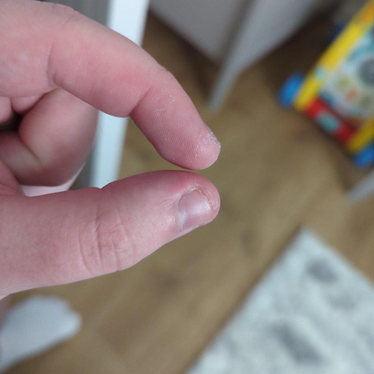 KaiSanderson's tweet image. Are we this close? #HowClose