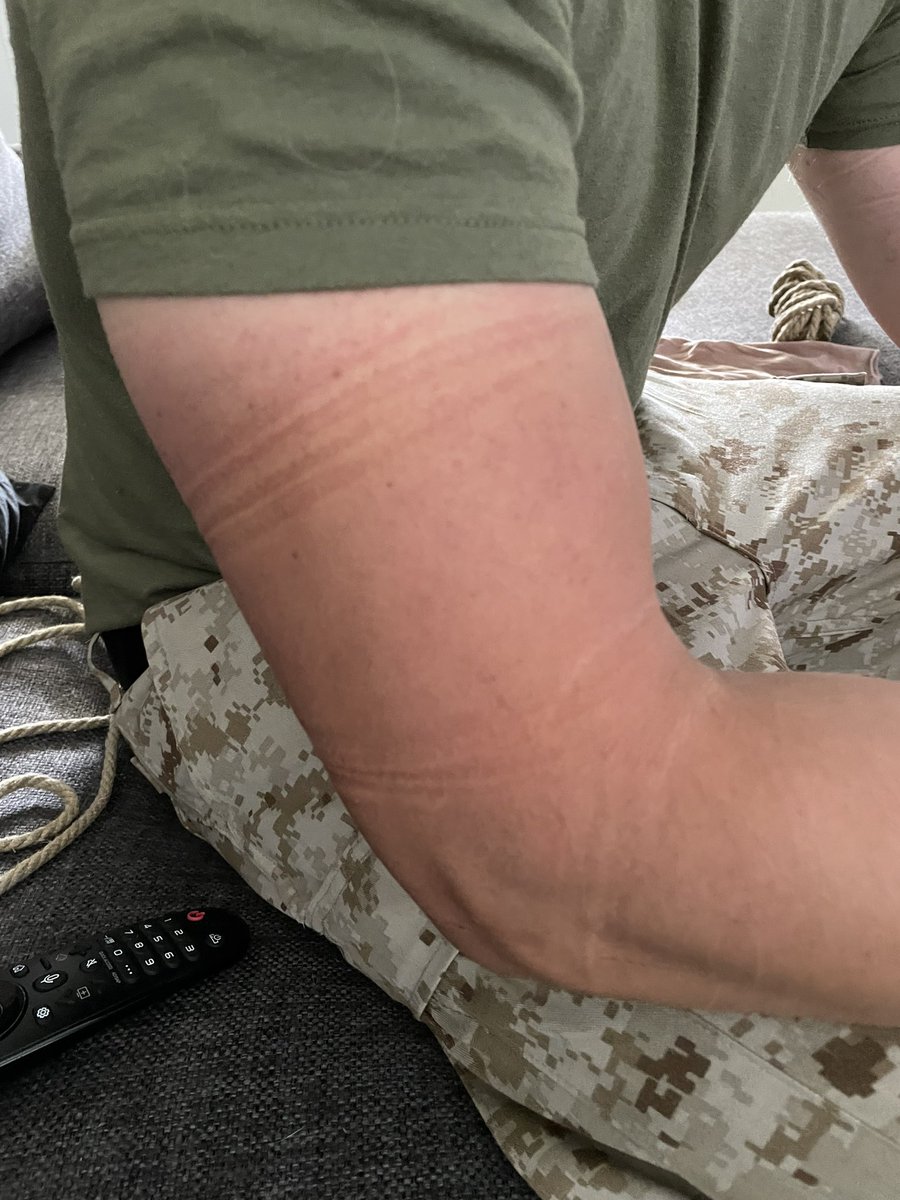 uniformdistress's tweet photo. An added bonus to roping @SwitchTied 
The “battle scars” 😱😱 https://t.co/Ah9xCxtblb