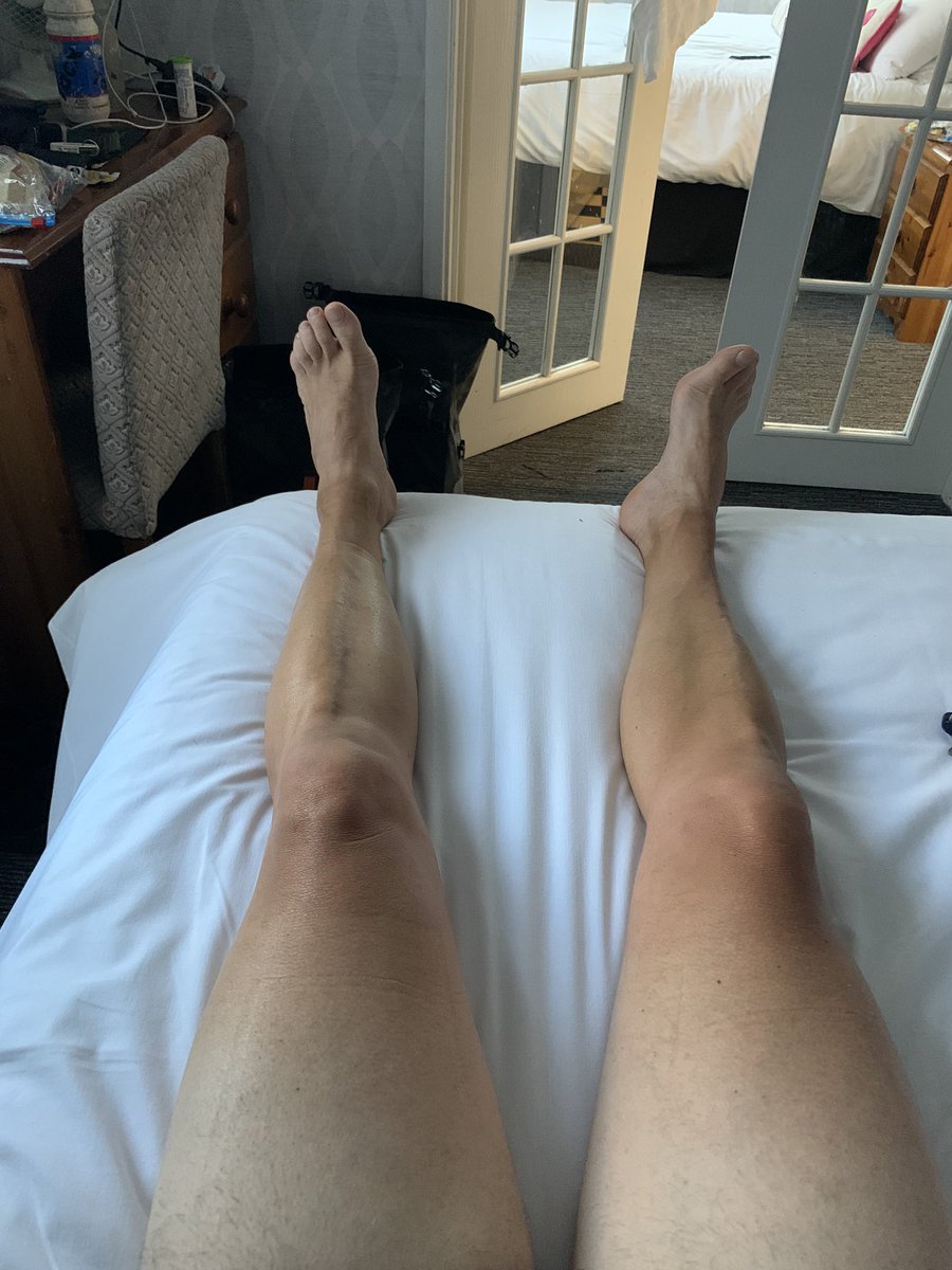 ethelthered's tweet photo. Where’s a masseur when you need one? #KingAlfredsWay https://t.co/e3xi8O5f00