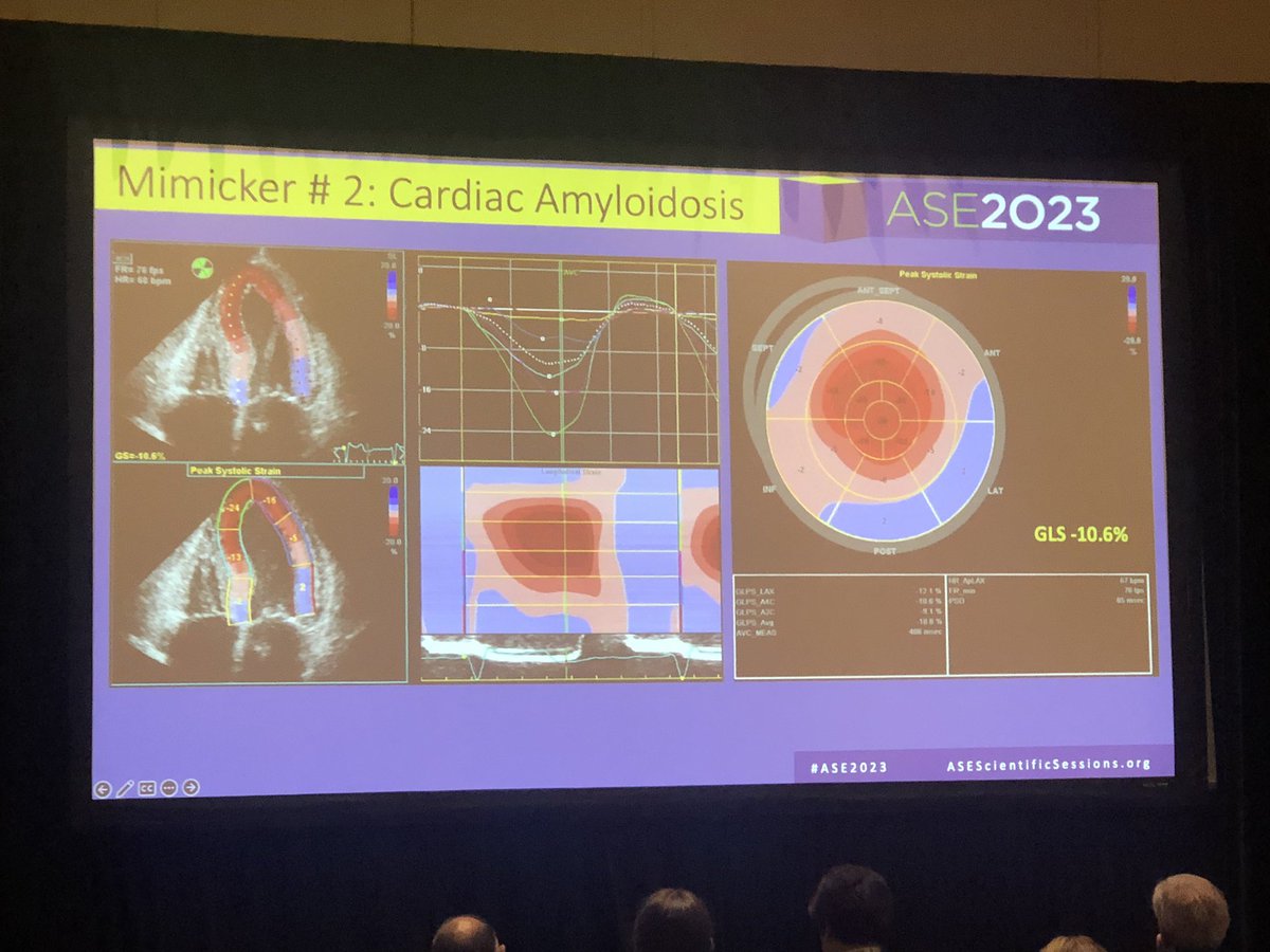 Anita Kelsey, MD, MBA (@anitakelseymd) on Twitter photo What might mimic HCM? Strain may help differentiate! Great presentation by our Alicia Armour! <a href="/DukeHeartCenter/">Duke Heart</a> #ASE2023 <a href="/pamelasdouglas/">Pamela S Douglas</a> <a href="/rpecho/">Richard Palma</a> What might mimic HCM? Strain may help differentiate! Great presentation by our Alicia Armour! <a href="/DukeHeartCenter/">Duke Heart</a> #ASE2023 <a href="/pamelasdouglas/">Pamela S Douglas</a> <a href="/rpecho/">Richard Palma</a>