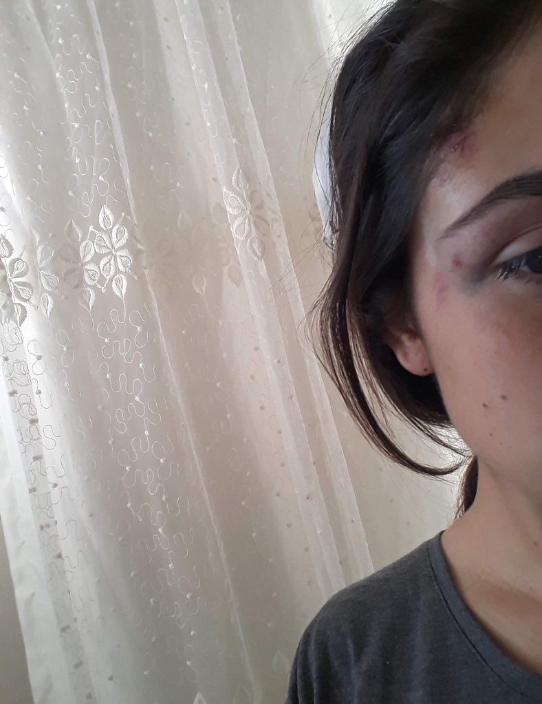 solcugazete's tweet image. Bir kız çocuğunun hayatının babası tarafından nasıl karartılmaya çalışıldığını onun sözlerinden dinleyelim: #BedriBaşaranTutuklansın

&quot;Ben Sevgi, 23 yaşındayım. Şanlıurfa Viranşehirliyim. Kadın sığınma evinde kaldığım için telefon kullanmam yasak. Şu an online dersim olduğu için…