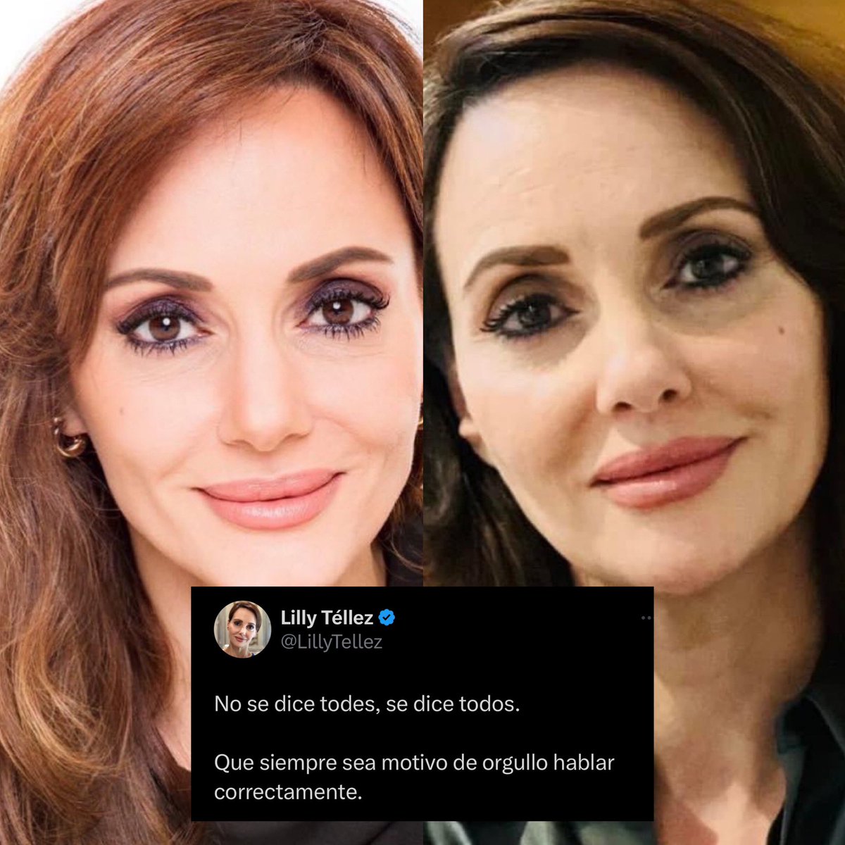 Cerebros tweet media