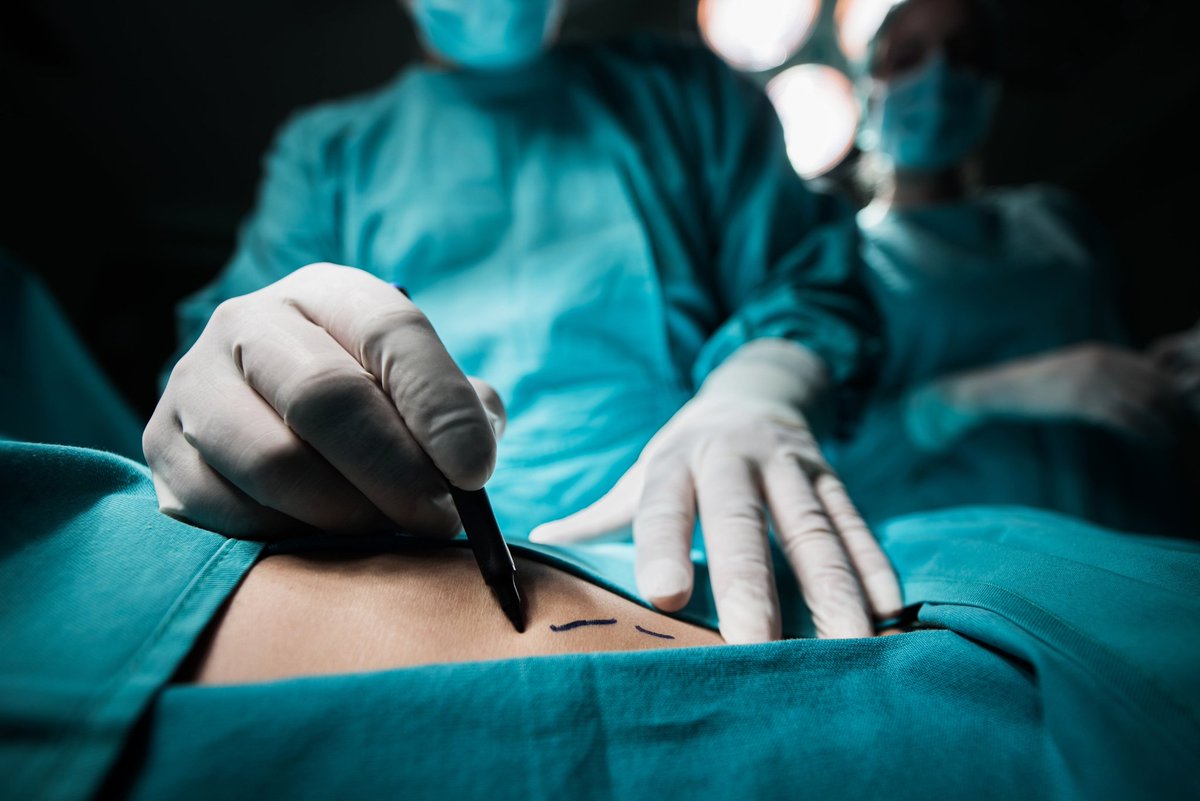 deep_strk's tweet photo. Have you come across any exclusive surgery videos on YouTube? What are your thoughts on these videos being accessible to the public? ๐ค Let's discuss in the comments below! ๐ฌ #surgeryvideos #YouTubers #discussion https://t.co/skc9p0D97E